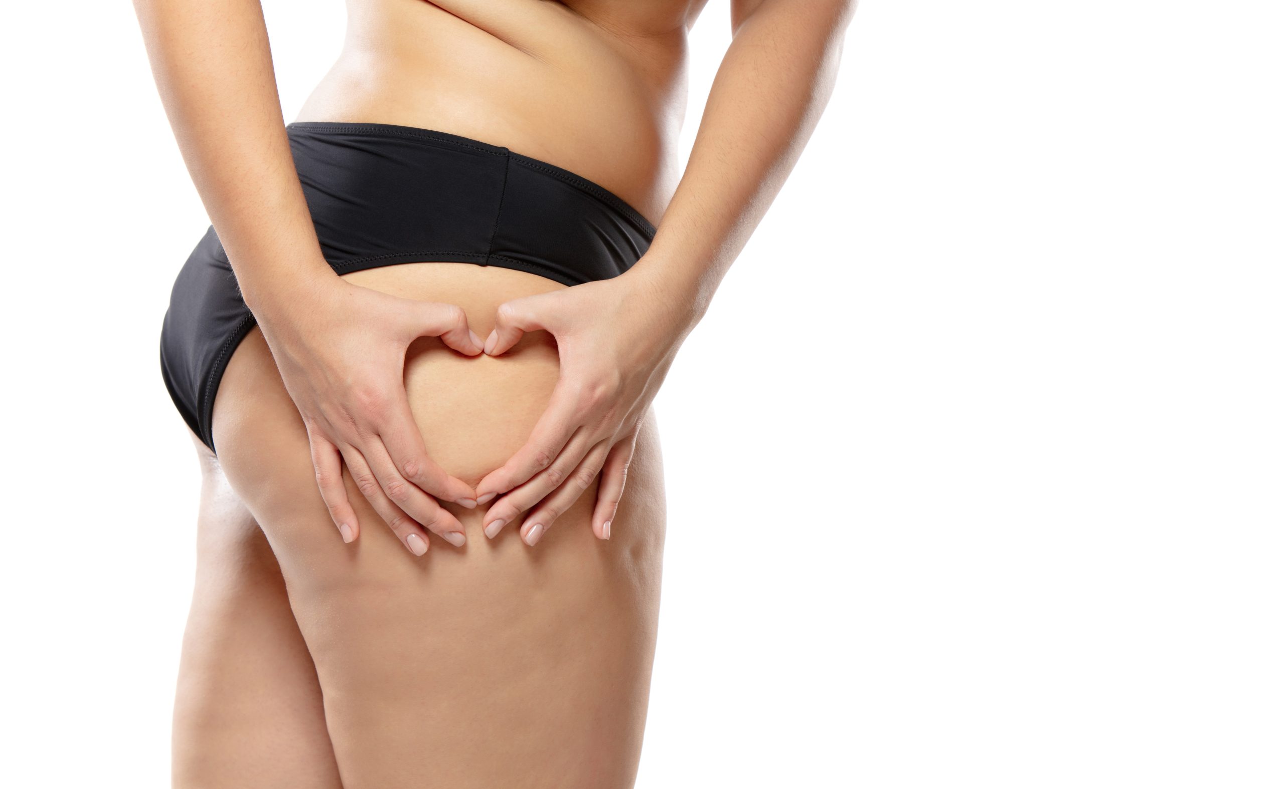 Overweight woman with fat cellulite legs and buttocks, obesity female body in black underwear isolated on white background. Orange peel skin, liposuction, beauty, healthcare and beauty treatment.